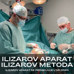 Ilizarov aparat ilizarov metoda nezarasli prelom operacija povećanje visine produženje nogu