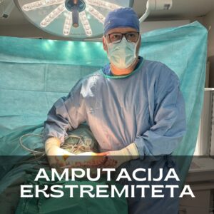 amputacija ekstremiteta ruke noge potkolena natkolena amputacija