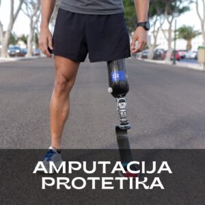 amputacija ekstremiteta ruke noge potkolena natkolena amputacija oporavak protetisanje