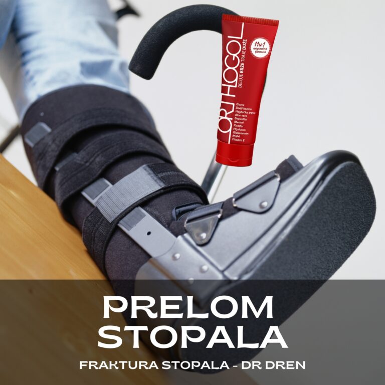 prelom stopala fraktura stopala prelom petne prelom skočne kosti prelom metatarzalne kosti