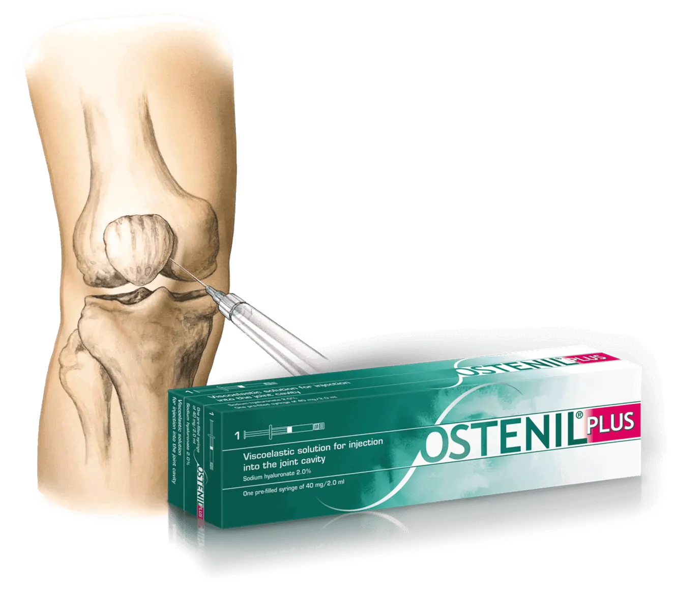 ostenil plus chondryal plus kartinorm injekcije hijalurona za koleno, reviscon, biolevox - Dr Dren ostenil plus chondryal plus kartinorm injekcije hijalurona za koleno, reviscon, biolevox