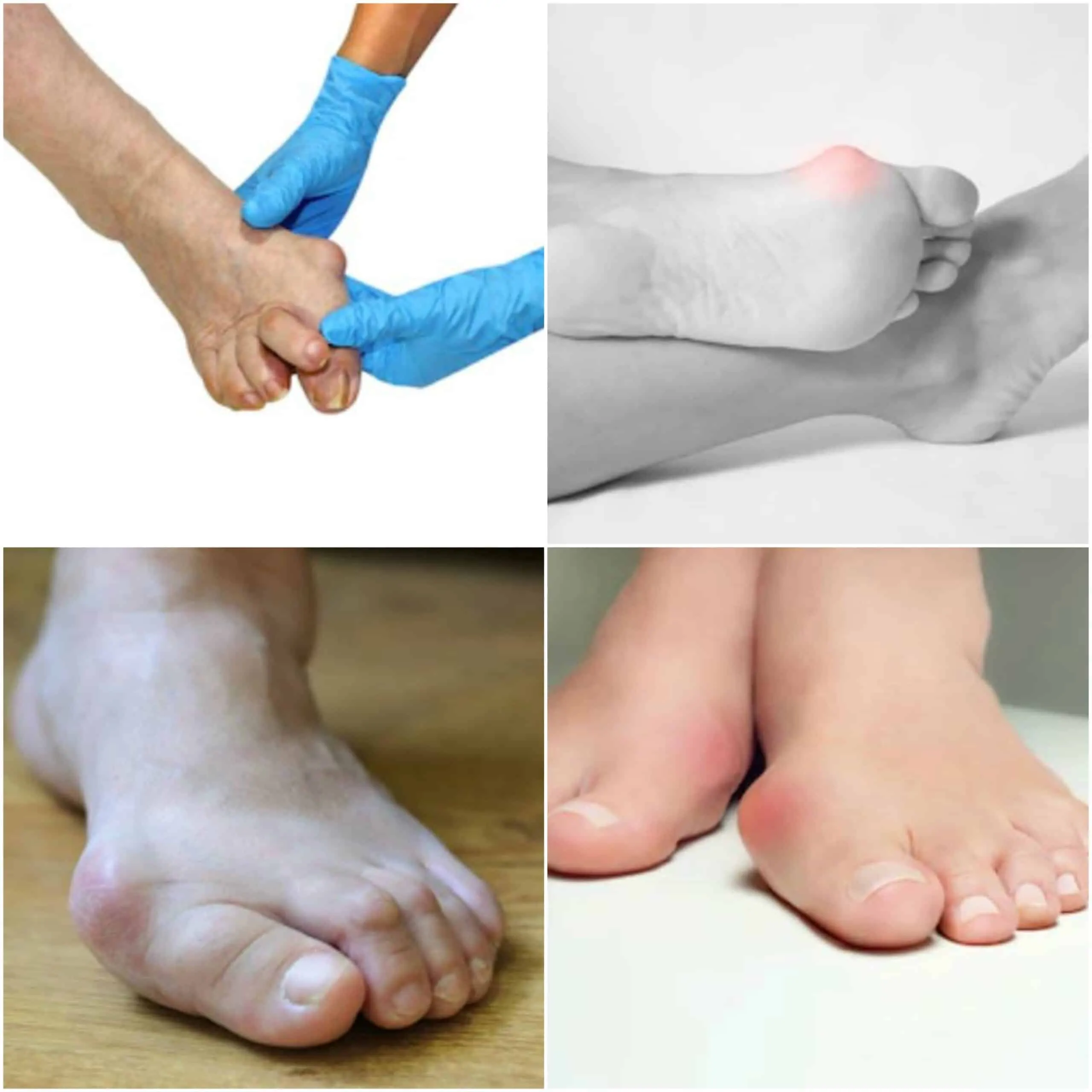 čukljevi zašto i kako nastaju čukljevi