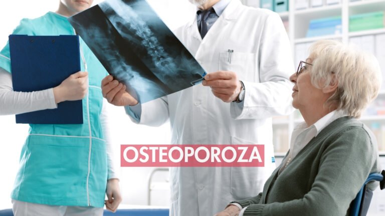 Osteoporoza šta je kako se leči