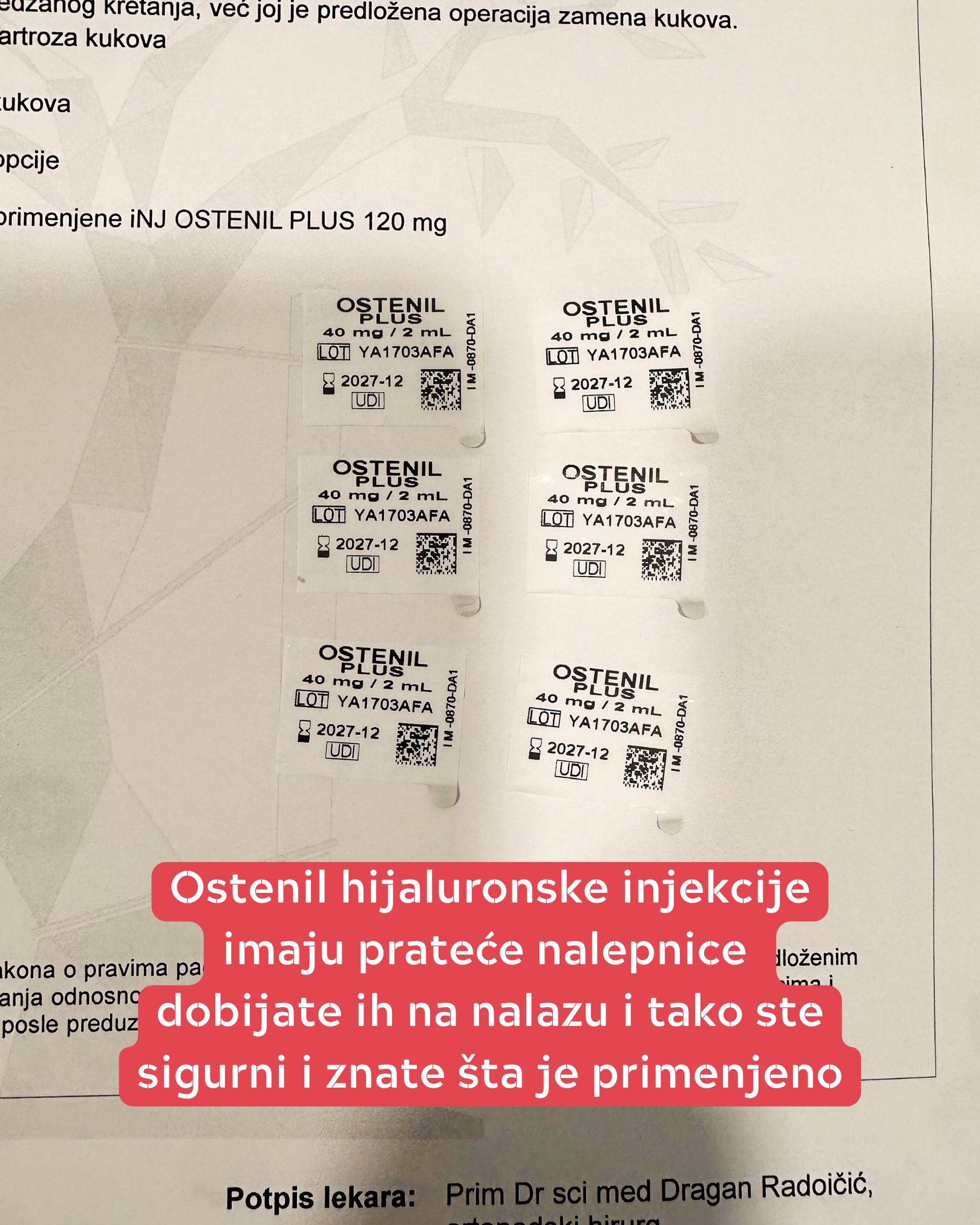 hijaluronska kiselina za zglobove injekcije hijalurona za koleno - Dr Dren hijaluronska kiselina za zglobove injekcije hijalurona za koleno