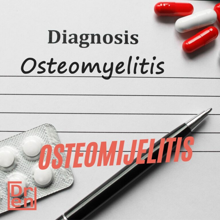 Osteomijelitis bakterijska nfekcija kosti upala kosti curenje iz rane infekcija kosti posle operacije