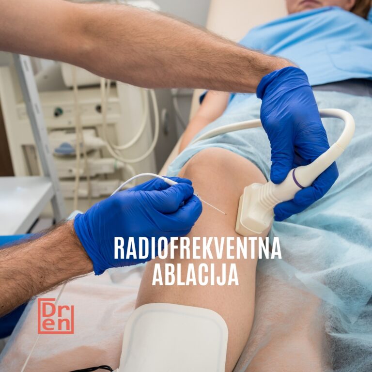 radiofrekeventna ablacija rfa hronični za bol u donjem delu leđa u kolenu kuku koksartroza gonartroza RFA