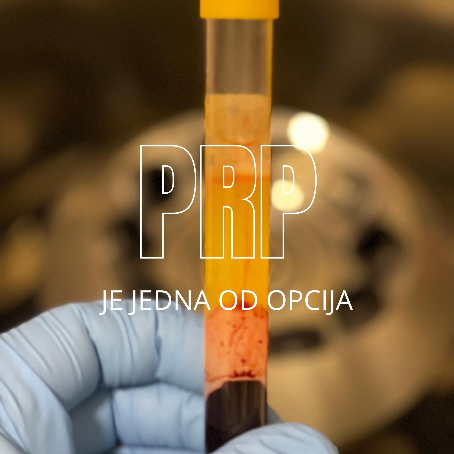 prp terapija prp tretman za tendinitis ahilove tetive - Dr Dren prp terapija prp tretman za tendinitis ahilove tetive