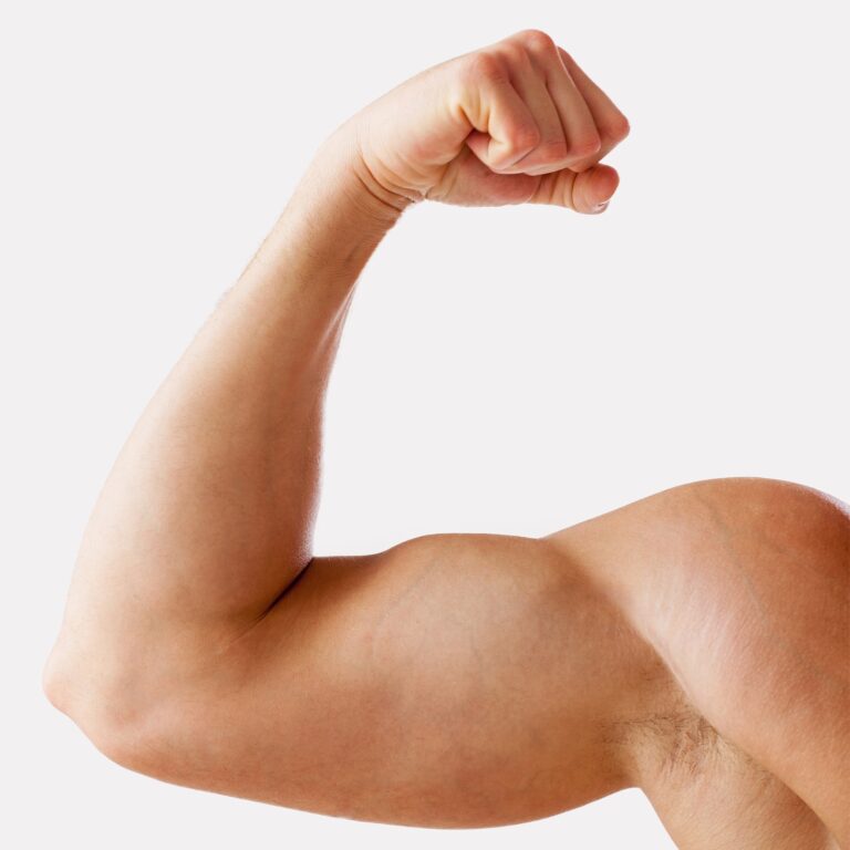 ruptura bicepsa tricepsa pectoralisa povreda trening oporavak operacija