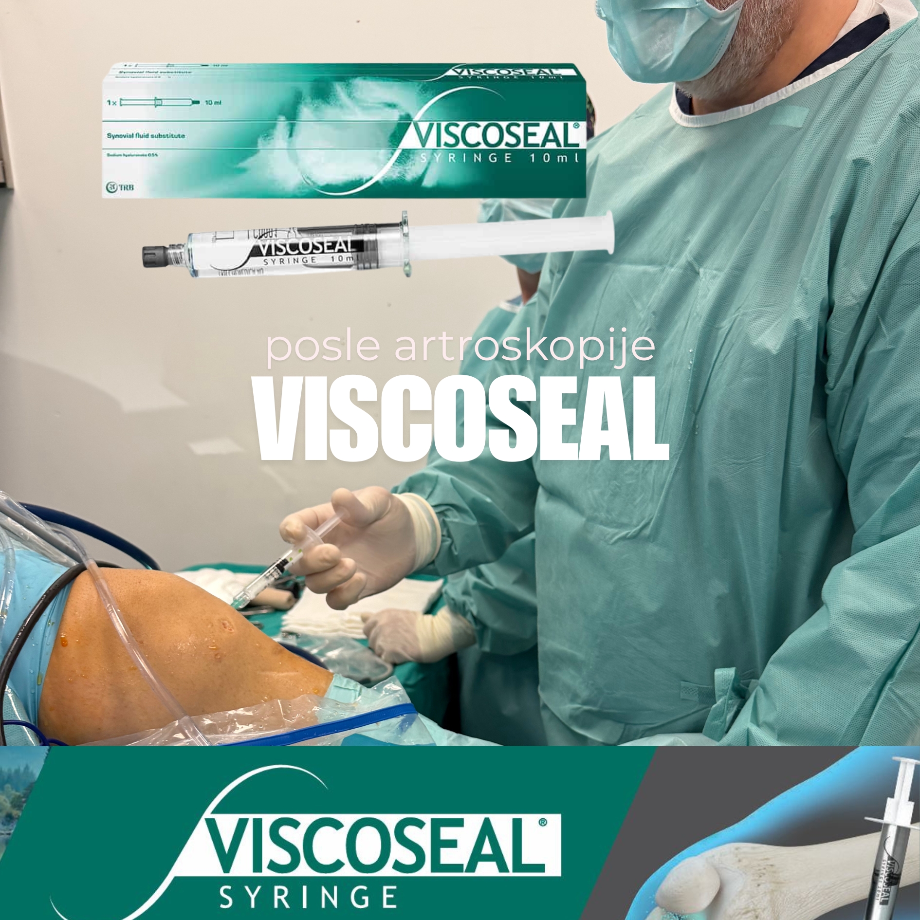 Viscoseal viskosil hijaluron oporavak artroskopija kolena