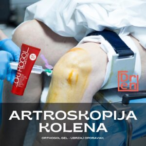 artroskopija kolena operacija kolena cena najbolji ortoped za koleno operacija meniskusa cena 2
