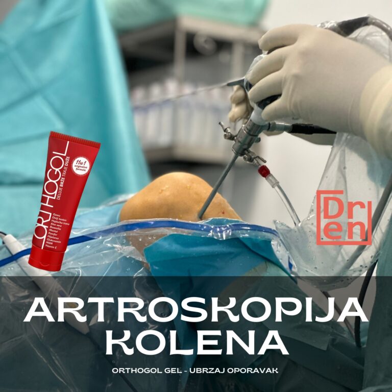 artroskopija kolena operacija kolena cena najbolji ortoped za koleno operacija meniskusa cena