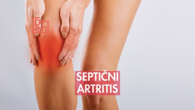 septični artritis infekcija zgloba (1)