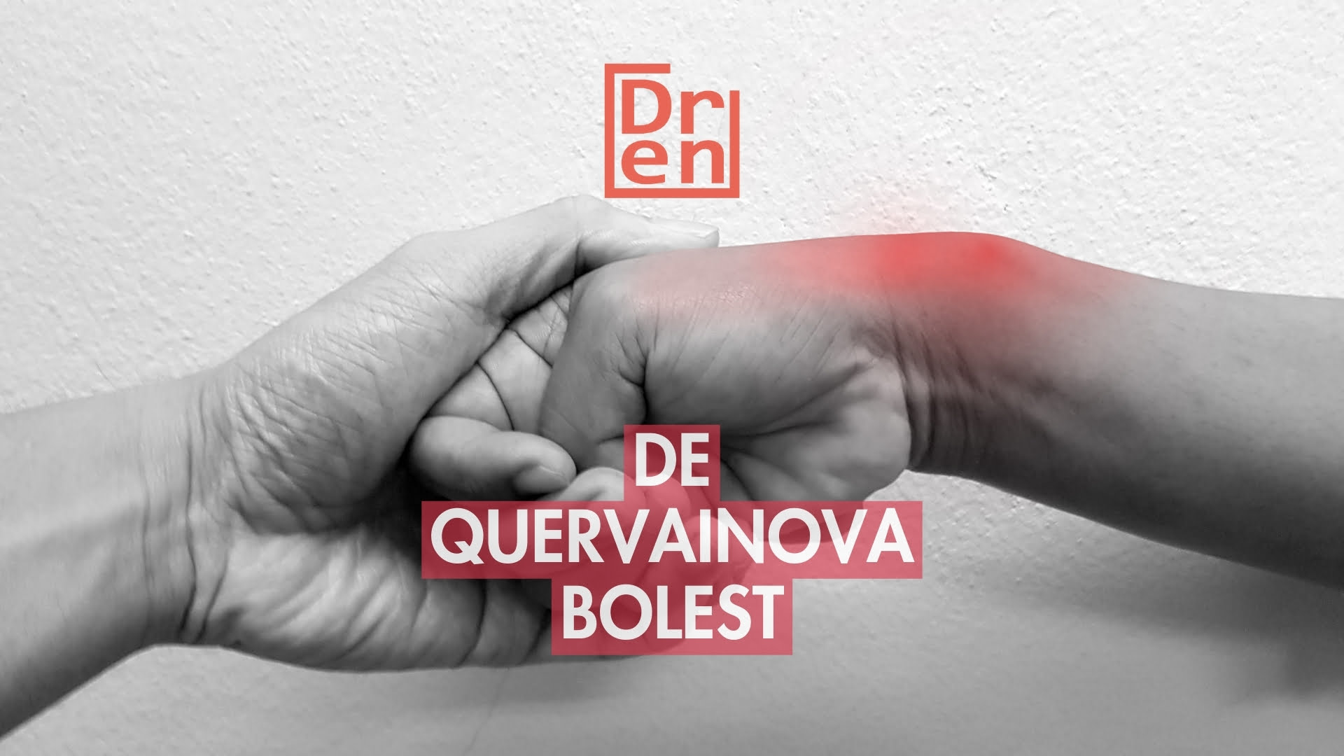 De Quervainova bolest De Quervain sindrom stenozirajući tenosinovitis tenosynovitis stenosans