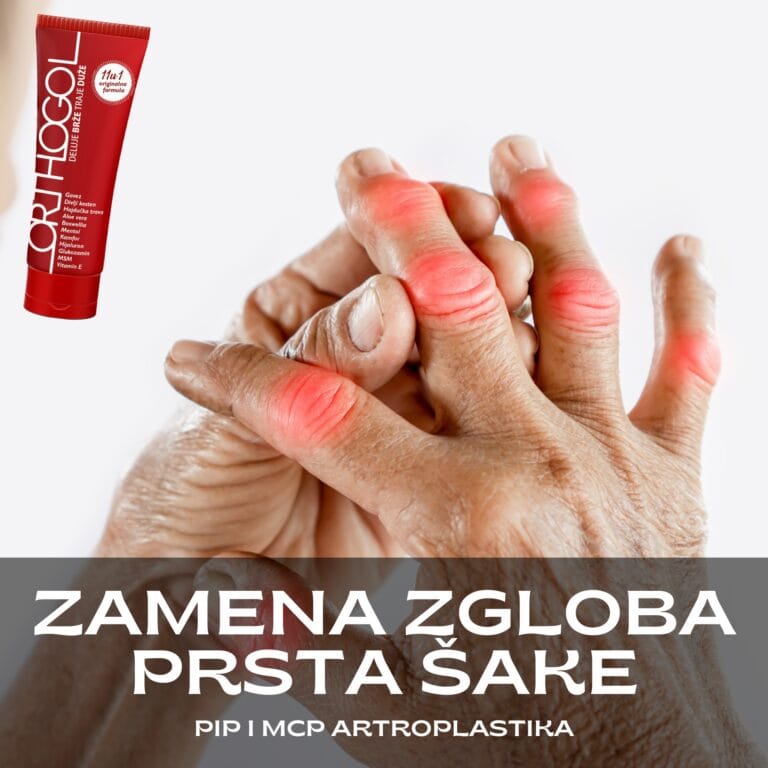 zamena zgloba prsta šake pip i mcp artroplastika