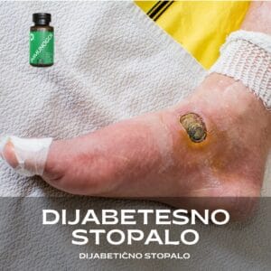 Dijabetesno stopalo, dijabetično stopalo
