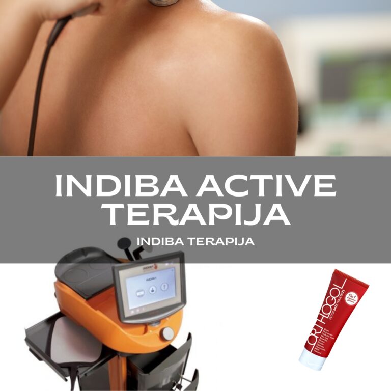 Indiba terapija, indiba terapija cena, indiba active, indiba beograd