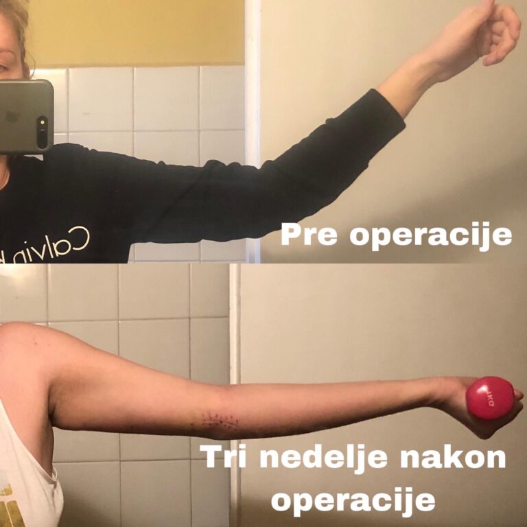 dr dren iskustva pre i posle operacije - Dr Dren dr dren iskustva pre i posle operacije
